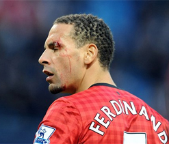 FA probing coin assault on Ferdinand during rancorous Manchester derby