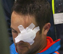 Mark Boucher undergoes eye surgery