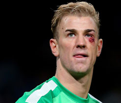 Hart fit to play for City after cut, says Pellegrini
